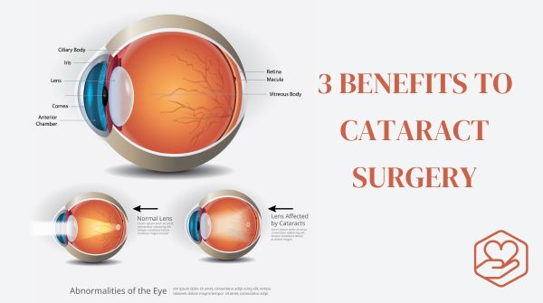 3 Benefits to Cataract Surgery